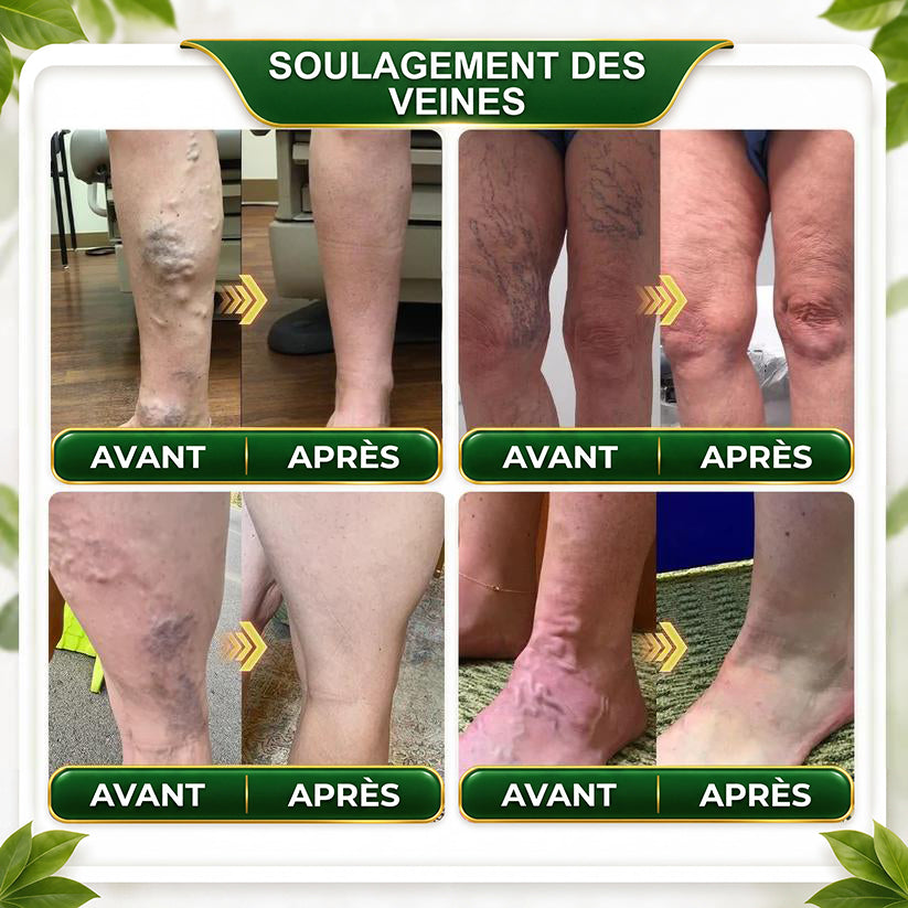 德☘️ GreenFeel® Berberin-Moringa-Bienengift Detox-Schlankheits-Fußbadperlen unterstützen das Gewichtsmanagement, die Lymphdrainage, eine gesunde Durchblutung, das weibliche Wohlbefinden und ein straffer wirkendes Hautbild. 🔥