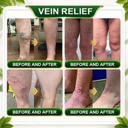 英☘️𝑮𝒓𝒆𝒆𝒏𝑭𝒆𝒆𝒍® 𝑩𝒆𝒓𝒃𝒆𝒓𝒊𝒏𝒆 𝑴𝒐𝒓𝒊𝒏𝒈𝒂- 𝑩𝒆𝒆 𝑽𝒆𝒏𝒐𝒎 𝑫𝒆𝒕𝒐𝒙 𝑺𝒍𝒊𝒎𝒎𝒊𝒏𝒈 𝑭𝒐𝒐𝒕 𝑺𝒐𝒂𝒌 𝑩𝒆𝒂𝒅 𝑺𝒖𝒑𝒑𝒐𝒓𝒕𝒔 𝑾𝒆𝒊𝒈𝒉𝒕 𝑴𝒂𝒏𝒂𝒈𝒆𝒎𝒆𝒏𝒕, 𝑳𝒚𝒎𝒑𝒉𝒂𝒕𝒊𝒄 𝑫𝒓𝒂𝒊𝒏𝒂𝒈𝒆, 𝑯𝒆𝒂𝒍𝒕𝒉𝒚 𝑪𝒊𝒓𝒄𝒖𝒍𝒂𝒕𝒊𝒐𝒏, 𝑭𝒆𝒎𝒊𝒏𝒊𝒏𝒆 𝑾𝒆𝒍𝒍𝒏𝒆𝒔𝒔 & 𝑭𝒊𝒓𝒎𝒆𝒓-𝑳𝒐𝒐𝒌𝒊𝒏𝒈 𝑺𝒌𝒊𝒏🔥