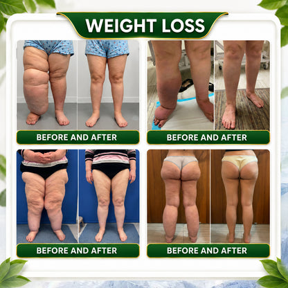 英☘️𝑮𝒓𝒆𝒆𝒏𝑭𝒆𝒆𝒍® 𝑩𝒆𝒓𝒃𝒆𝒓𝒊𝒏𝒆 𝑴𝒐𝒓𝒊𝒏𝒈𝒂- 𝑩𝒆𝒆 𝑽𝒆𝒏𝒐𝒎 𝑫𝒆𝒕𝒐𝒙 𝑺𝒍𝒊𝒎𝒎𝒊𝒏𝒈 𝑭𝒐𝒐𝒕 𝑺𝒐𝒂𝒌 𝑩𝒆𝒂𝒅 𝑺𝒖𝒑𝒑𝒐𝒓𝒕𝒔 𝑾𝒆𝒊𝒈𝒉𝒕 𝑴𝒂𝒏𝒂𝒈𝒆𝒎𝒆𝒏𝒕, 𝑳𝒚𝒎𝒑𝒉𝒂𝒕𝒊𝒄 𝑫𝒓𝒂𝒊𝒏𝒂𝒈𝒆, 𝑯𝒆𝒂𝒍𝒕𝒉𝒚 𝑪𝒊𝒓𝒄𝒖𝒍𝒂𝒕𝒊𝒐𝒏, 𝑭𝒆𝒎𝒊𝒏𝒊𝒏𝒆 𝑾𝒆𝒍𝒍𝒏𝒆𝒔𝒔 & 𝑭𝒊𝒓𝒎𝒆𝒓-𝑳𝒐𝒐𝒌𝒊𝒏𝒈 𝑺𝒌𝒊𝒏🔥