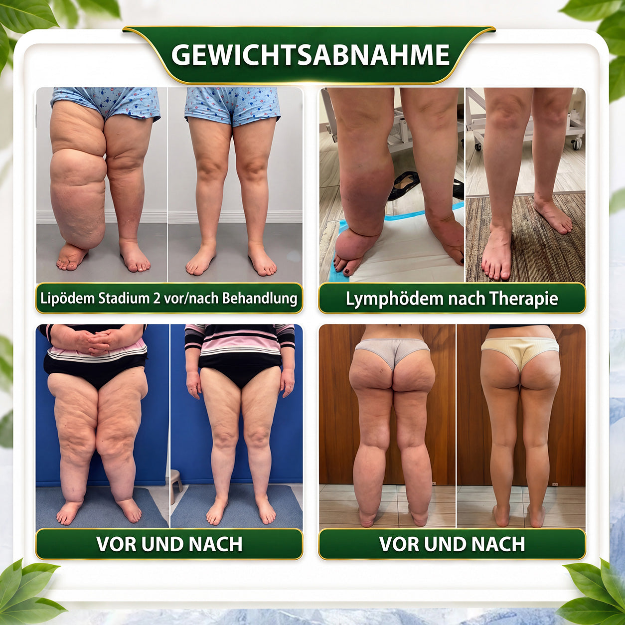 德☘️ GreenFeel® Berberin-Moringa-Bienengift Detox-Schlankheits-Fußbadperlen unterstützen das Gewichtsmanagement, die Lymphdrainage, eine gesunde Durchblutung, das weibliche Wohlbefinden und ein straffer wirkendes Hautbild. 🔥