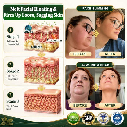英☘️𝑮𝒓𝒆𝒆𝒏𝑭𝒆𝒆𝒍® 𝑩𝒆𝒓𝒃𝒆𝒓𝒊𝒏𝒆 𝑴𝒐𝒓𝒊𝒏𝒈𝒂- 𝑩𝒆𝒆 𝑽𝒆𝒏𝒐𝒎 𝑫𝒆𝒕𝒐𝒙 𝑺𝒍𝒊𝒎𝒎𝒊𝒏𝒈 𝑭𝒐𝒐𝒕 𝑺𝒐𝒂𝒌 𝑩𝒆𝒂𝒅 𝑺𝒖𝒑𝒑𝒐𝒓𝒕𝒔 𝑾𝒆𝒊𝒈𝒉𝒕 𝑴𝒂𝒏𝒂𝒈𝒆𝒎𝒆𝒏𝒕, 𝑳𝒚𝒎𝒑𝒉𝒂𝒕𝒊𝒄 𝑫𝒓𝒂𝒊𝒏𝒂𝒈𝒆, 𝑯𝒆𝒂𝒍𝒕𝒉𝒚 𝑪𝒊𝒓𝒄𝒖𝒍𝒂𝒕𝒊𝒐𝒏, 𝑭𝒆𝒎𝒊𝒏𝒊𝒏𝒆 𝑾𝒆𝒍𝒍𝒏𝒆𝒔𝒔 & 𝑭𝒊𝒓𝒎𝒆𝒓-𝑳𝒐𝒐𝒌𝒊𝒏𝒈 𝑺𝒌𝒊𝒏🔥